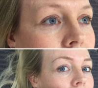 Jane Simpson Brows image 1